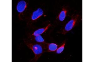 IF analysis of DDX4 using anti-DDX4 antibody (ABIN7601203). (DDX4 antibody  (AA 3-666))