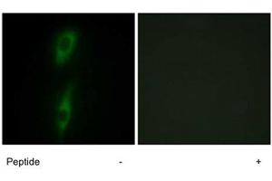 Immunofluorescence analysis of HeLa cells, using ACVRL1 polyclonal antibody .