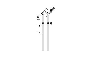 CNBP Antibody (Center) (ABIN1881216 and ABIN2839107) western blot analysis in MCF-7 cell line and rat spleen tissue lysates (35 μg/lane). (CNBP antibody  (AA 91-118))