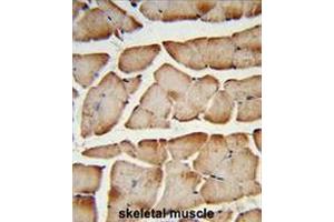 Formalin-fixed and paraffin-embedded human skeletal muscle reacted with T150A Antibody (Center), which was peroxidase-conjugated to the secondary antibody, followed by DAB staining. (TMEM150A antibody  (Middle Region))