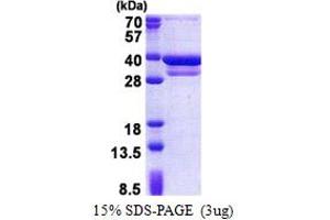 CUE Domain Containing 2 (CUEDC2) (AA 1-287) protein (His tag)