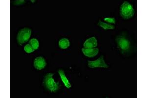 Immunofluorescent analysis of MCF-7 cells using ABIN7175320 at dilution of 1:100 and Alexa Fluor 488-congugated AffiniPure Goat Anti-Rabbit IgG(H+L) (VPS4B antibody  (AA 1-117))