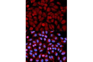 Immunofluorescence analysis of U2OS cells using MAPK9 antibody. (JNK2 antibody)