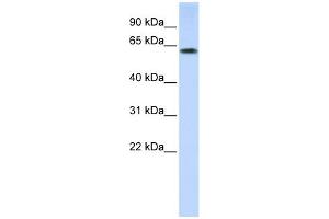 WB Suggested Anti-TRIM55 Antibody Titration:  0. (TRIM55 antibody  (N-Term))