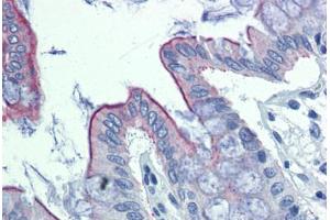 Human Colon: Formalin-Fixed, Paraffin-Embedded (FFPE) (ABHD5 antibody  (C-Term))