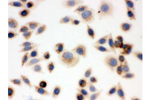 Immunohistochemistry (IHC) image for anti-BCL2-Antagonist/killer 1 (BAK1) (AA 22-211) antibody (ABIN3042342)