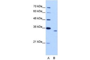 WB Suggested Anti-RBM4B  Antibody Titration: 2. (RBM4B antibody  (C-Term))