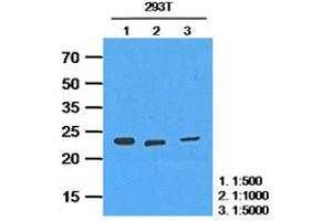 Western Blotting (WB) image for anti-Hypoxanthine phosphoribosyltransferase 1 (HPRT1) antibody (ABIN781535) (HPRT1 antibody)