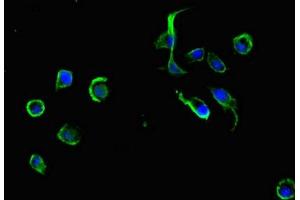 Immunofluorescent analysis of MCF-7 cells using ABIN7164909 at dilution of 1:100 and Alexa Fluor 488-congugated AffiniPure Goat Anti-Rabbit IgG(H+L) (ADRM1 antibody  (AA 2-407))