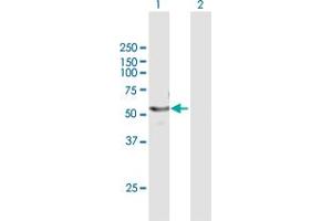 CYP4F22 antibody  (AA 1-531)