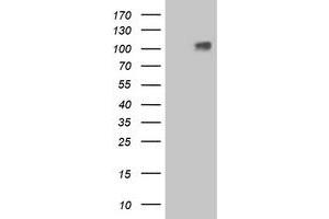 Western Blotting (WB) image for anti-Leucine-Rich Repeat Containing G Protein-Coupled Receptor 4 (LGR4) (AA 230-540) antibody (ABIN1491239)