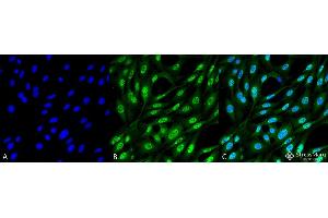 Immunocytochemistry/Immunofluorescence analysis using Mouse Anti-Ubiquitin Monoclonal Antibody, Clone FK2 . (Ubiquitin antibody  (PerCP))