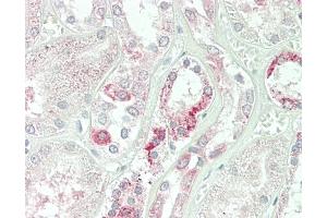 Formalin-fixed and paraffin-embedded H. (C1GALT1 antibody  (AA 115-144))