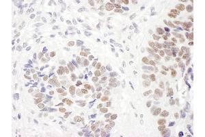 Immunohistochemistry (IHC) image for anti-MutS Homolog 6 (E. Coli) (MSH6) (AA 350-400) antibody (ABIN7454510)