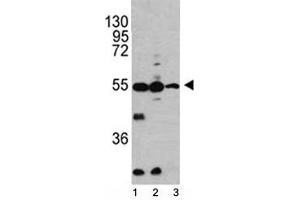Western blot analysis of Caspase-2 antibody and 1) HL-60, 2) K562, 3) Ramos lysate. (Caspase 2 antibody  (AA 198-226))