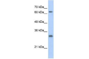 WB Suggested Anti-USP39 Antibody Titration:  0.