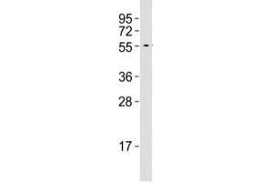 Western blot testing of MMP14 antibody at 1:500 dilution + A2058 lysate; Predicted band size : 66 kDa.