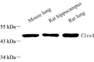 Western blot analysis of Clavesin 1 (ABIN7073517) at dilution of 1: 1000,Lane 1: Mouse lung tissue lysate,Lane 2: Rat ppocampus tissue lysate,Lane 3: Rat lung tissue lysate (Clavesin 1 antibody)