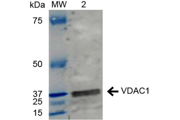 VDAC1 抗体  (N-Term) (Biotin)