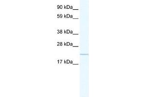 GTL3 antibody used at 5 ug/ml to detect target protein. (C16orf80 antibody  (C-Term))