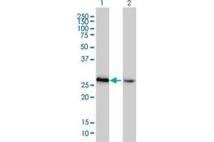 Western Blot analysis of HMGB2 expression in transfected 293T cell line by HMGB2 monoclonal antibody (M02), clone 4G7. (HMGB2 antibody  (AA 1-195))