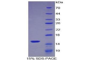 SDS-PAGE (SDS) image for S100 Calcium Binding Protein A9 (S100A9) (AA 1-113) protein (His tag) (ABIN1080762) (S100A9 Protein (AA 1-113) (His tag))