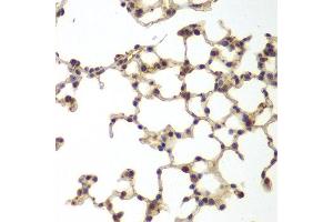 Immunohistochemistry of paraffin-embedded mouse lung using GSS antibody at dilution of 1:200 (400x lens). (Glutathione Synthetase antibody)