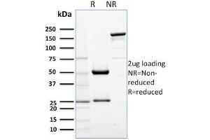 SDS-PAGE Analysis Purified AKT1 Mouse Monoclonal Antibody (AKT1/2552). (AKT1 antibody  (AA 85-189))