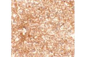 Immunohistochemistry of EPAC3 in mouse liver tissue with EPAC3 Antibody at 2.