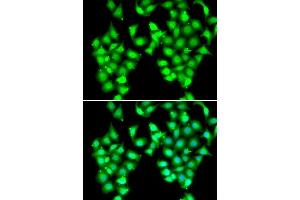 Immunofluorescence analysis of MCF7 cells using ATOH1 antibody. (ATOH1 antibody  (AA 215-354))