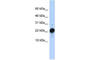 WB Suggested Anti-CSHL1 Antibody Titration:  0. (CSHL1 antibody  (C-Term))