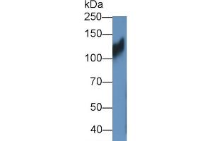 Detection of ITGb1 in HT1080 cell lysate using Polyclonal Antibody to Integrin Beta 1 (ITGb1) (ITGB1 antibody  (AA 454-714))