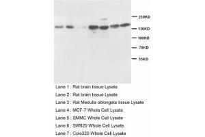 Image no. 2 for anti-Nitric Oxide Synthase 1, Neuronal (NOS1) (AA 1418-1434) antibody (ABIN1493385) (NOS1 antibody  (AA 1418-1434))