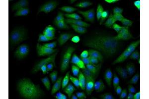 Image provided by One World Lab validation program. (XIAP antibody  (AA 201-330))