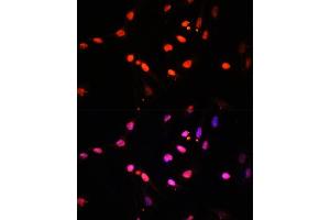 Immunofluorescence analysis of U2OS cells using KDM6B antibody (ABIN6131823, ABIN6142806, ABIN6142809 and ABIN6216507) at dilution of 1:100. (Kdm6b antibody  (AA 265-450))