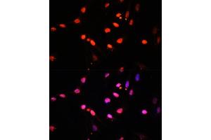 Immunofluorescence analysis of U2OS cells using KDM6B antibody (ABIN6131823, ABIN6142806, ABIN6142809 and ABIN6216507) at dilution of 1:100.