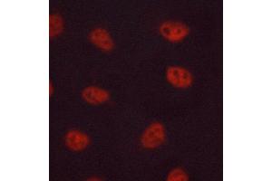 ABIN6268643 staining MCF-7 cells by ICC/IF. (FOSB antibody)