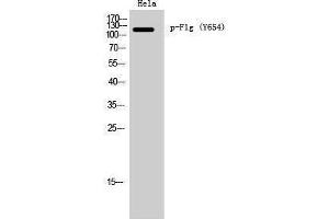 Western Blotting (WB) image for anti-Filaggrin (FLG) (pTyr654) antibody (ABIN3173166) (Filaggrin antibody  (pTyr654))