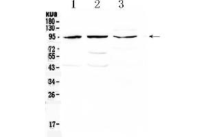 Western blot analysis of CD105 using anti- CD105 antibody . (Endoglin antibody  (Middle Region))