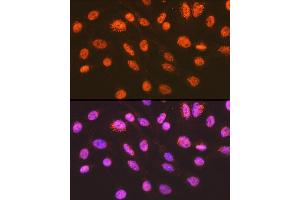 Immunofluorescence analysis of C6 cells using ENT2/SLC29 Rabbit mAb (ABIN7270448) at dilution of 1:100 (40x lens). (SLC29A2 antibody)