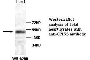 Image no. 1 for anti-Calponin 3, Acidic (CNN3) (C-Term) antibody (ABIN790991)
