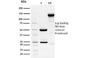 SDS-PAGE Analysis Purified HPV-18 Mouse Monoclonal Antibody (HPV16 E1/E4). (Human Papilloma Virus 16 E1, E4 (HPV-16 E1, E4) (AA 36-41) antibody)