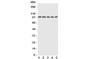 Western blot testing of Progesterone Receptor antibody and Lane 1: human HeLa (Progesterone Receptor antibody  (AA 595-933))