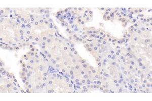 Detection of PDCD6 in Human Kidney Tissue using Polyclonal Antibody to Programmed Cell Death Protein 6 (PDCD6) (PDCD6 antibody  (AA 32-191))