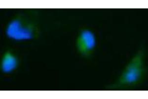 Image no. 1 for anti-Carbonic Anhydrase 12 (CA12) antibody (ABIN1497065) (CA12 antibody)