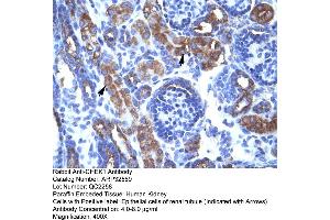 Human kidney (CHEK1 antibody  (Middle Region))
