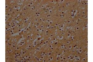 IHC image of ABIN7161274 diluted at 1:300 and staining in paraffin-embedded human brain tissue performed on a Leica BondTM system. (NEFH antibody  (AA 825-1003))