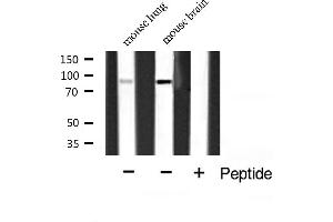 Western blot analysis of ABCF1 Antibody expression in mouse brain and mouse lung tissues lysates. (ABCF1 antibody  (C-Term))