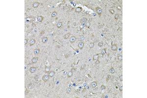 Immunohistochemistry (Paraffin-embedded Sections) (IHC (p)) image for anti-Eukaryotic Translation Initiation Factor 3 Subunit C (EIF3C) (AA 694-913) antibody (ABIN6140055)