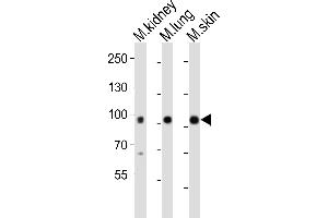 Western blot analysis of lysates from mouse kidney, mouse lung, mouse skin tissue (from left to right), using Epha1 Antibody (N-term) (ABIN6242303 and ABIN6577697). (EPHA1 antibody  (N-Term))